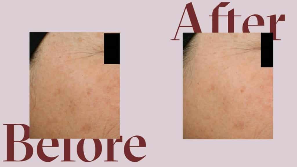 reviews on proven skincare