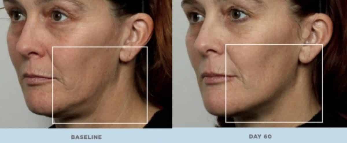 NuFACE Skincare Review - Must Read This Before Buying