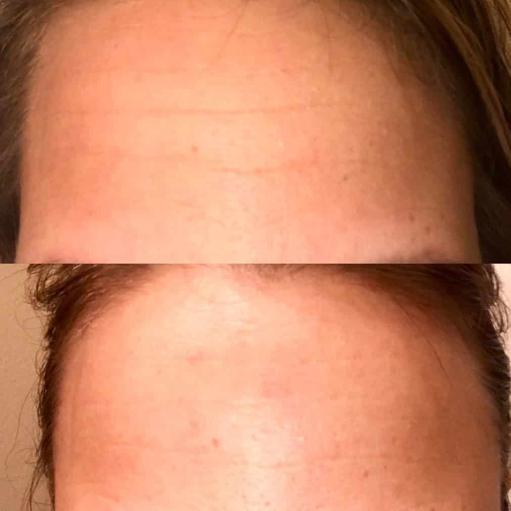 SiO Beauty Review 16 SiO Beauty Review