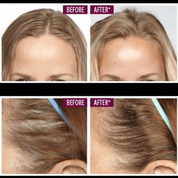 Keranique Hair Regrowth Review Must Read This Before Buying