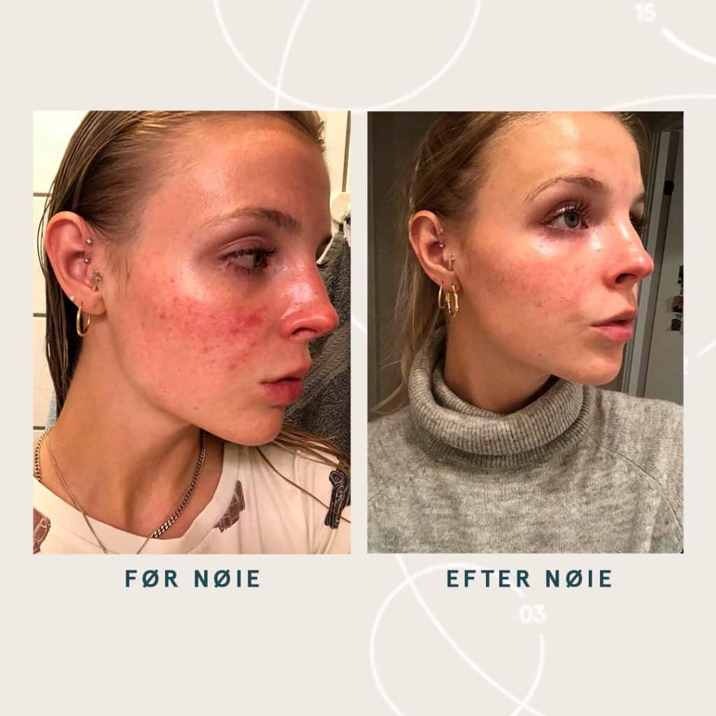 Noie Skincare Review