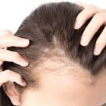 Rogaine review Rogaine Review - Must Read This Before Buying