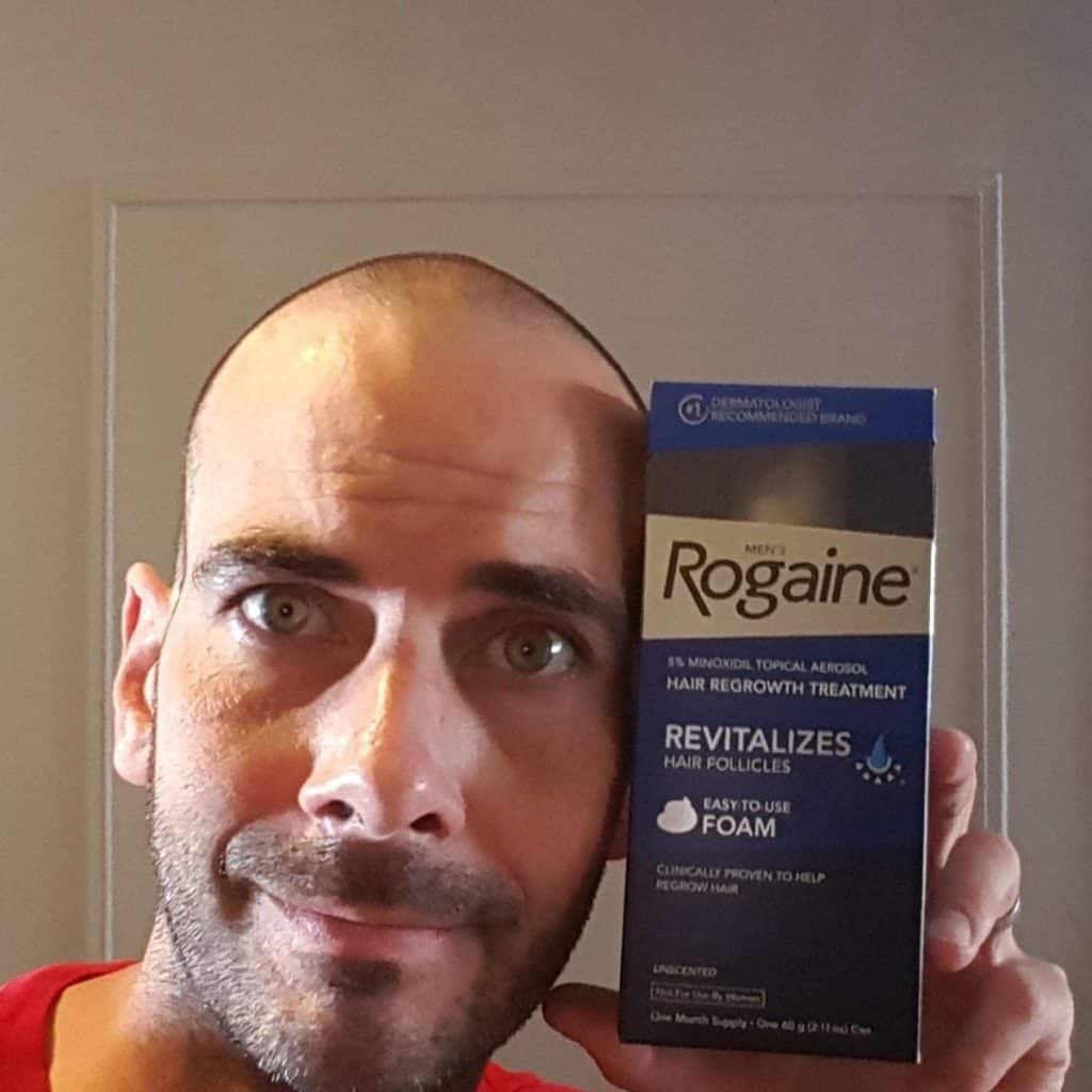 Rogaine Review - Must Read This Before Buying
