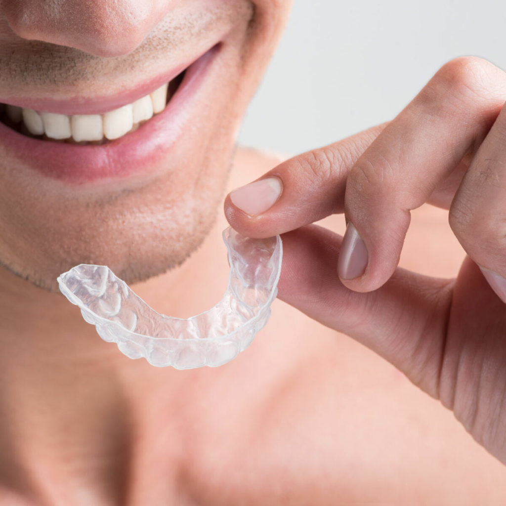 Byte Aligners Review