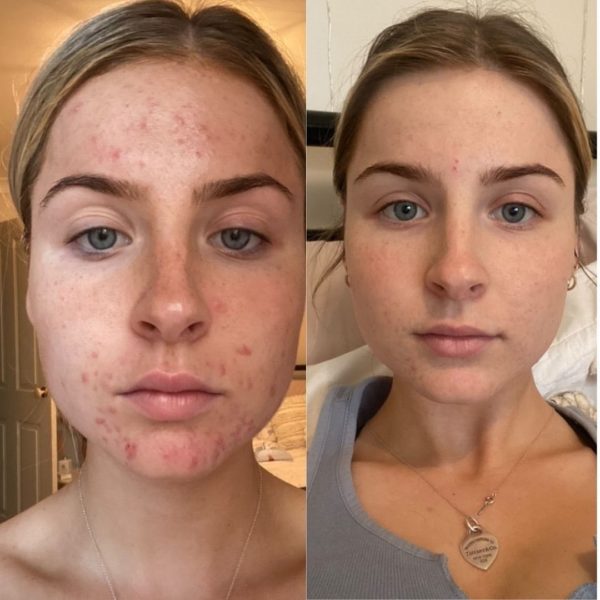 JSHealth Vitamins Review Must Read This Before Buying