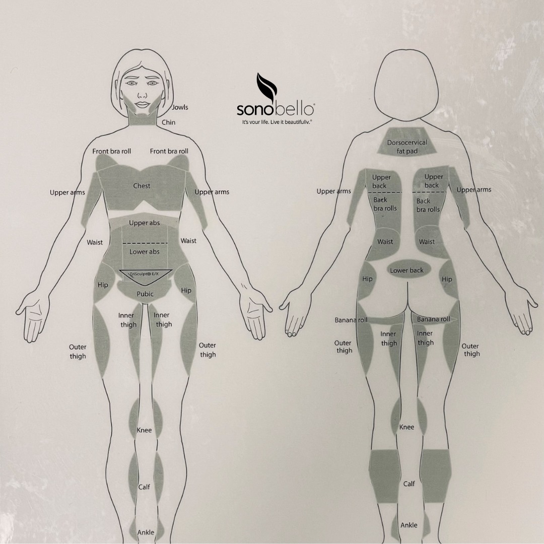 Sono Bello Review - Must Read This Before Buying