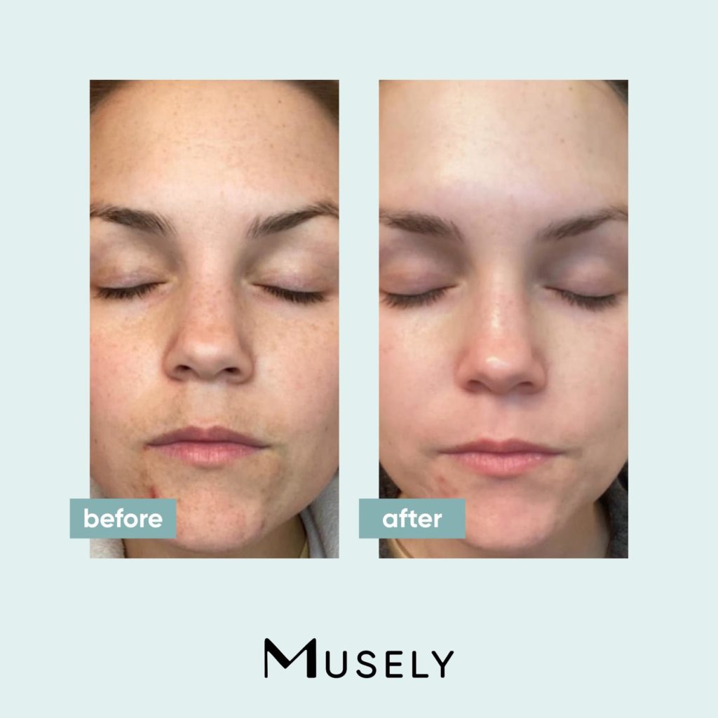 Musely Skincare Review