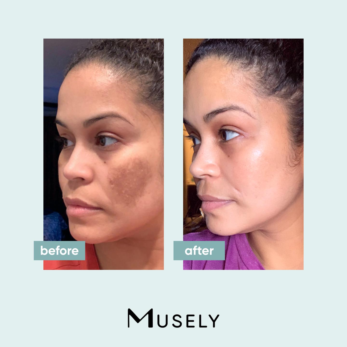 Musely Skincare Review Must Read This Before Buying