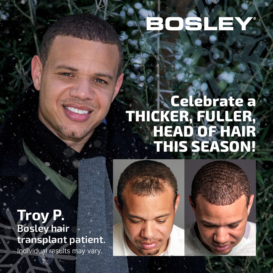 Bosley Hair Review