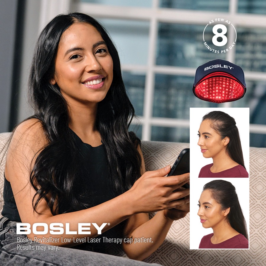 Bosley Hair Review