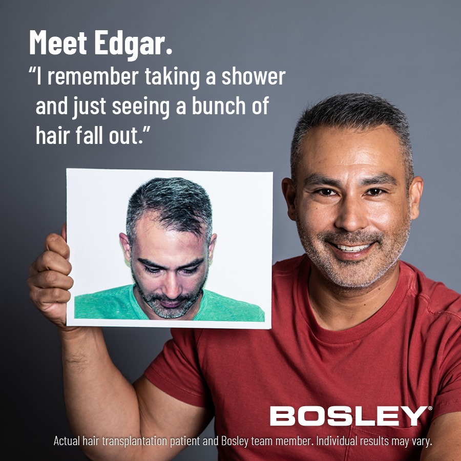 Bosley Hair Review