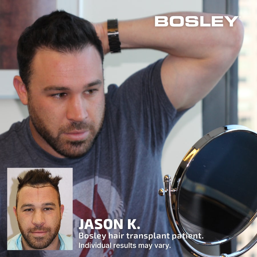 Bosley Hair Review