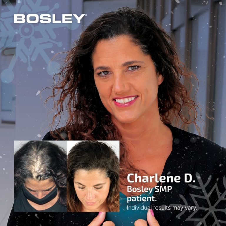 Bosley Hair Review - Must Read This Before Buying