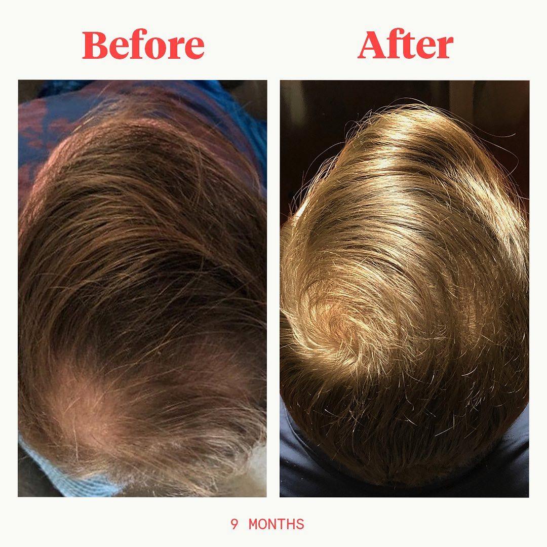 Keeps Hair Review Clicket Reviews