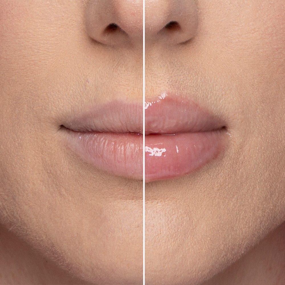 10 Best Lip Plumpers