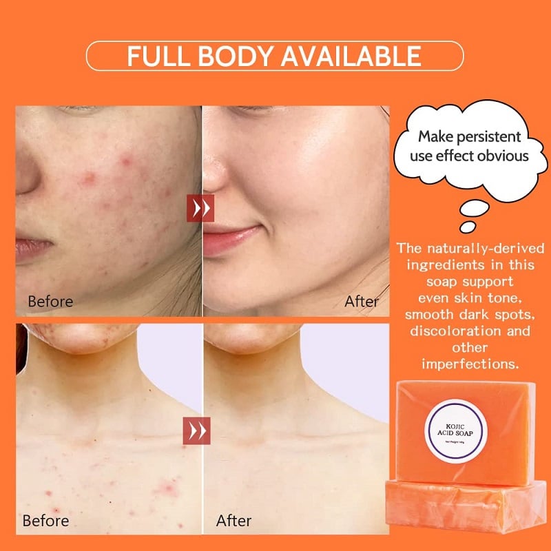 Kojic Acid Soap Before and After: Does It Really Lighten Skin? 2 Kojic Acid Soap Before and After: Does It Really Lighten Skin?