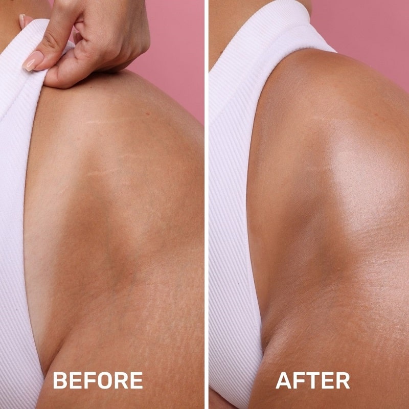 Maelys Cosmetics Before and After: A Comprehensive Review of the Results 2 Maelys Cosmetics Before and After: A Comprehensive Review of the Results