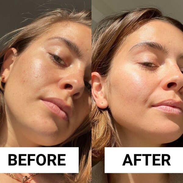Retinol Before and After Transform Your Skin with These Results Must Read This Before Buying