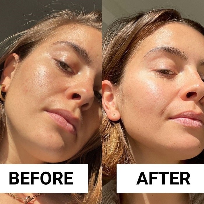 Retinol Before and After: Transform Your Skin with These Results