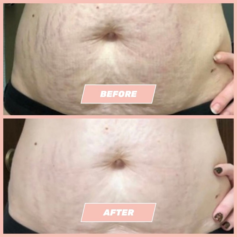 Maelys Cosmetics Before and After: A Comprehensive Review of the Results 11 Maelys Cosmetics Before and After: A Comprehensive Review of the Results