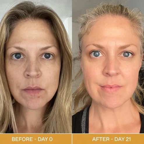 Red Light Therapy Before and After: Does It Really Work? 12 Red Light Therapy Before and After: Does It Really Work?