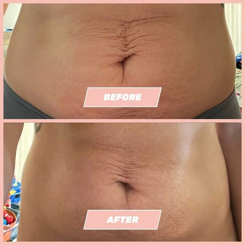 Maelys Cosmetics Before and After: A Comprehensive Review of the Results 13 Maelys Cosmetics Before and After: A Comprehensive Review of the Results