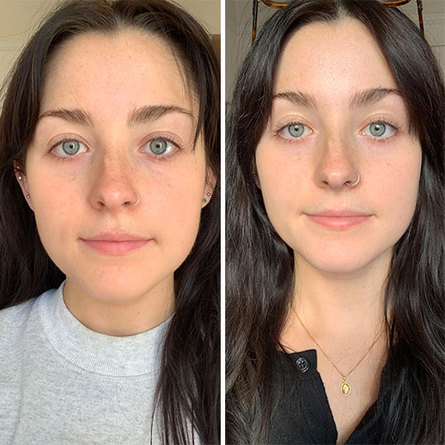 Gua Sha Before and After: Benefits and Results