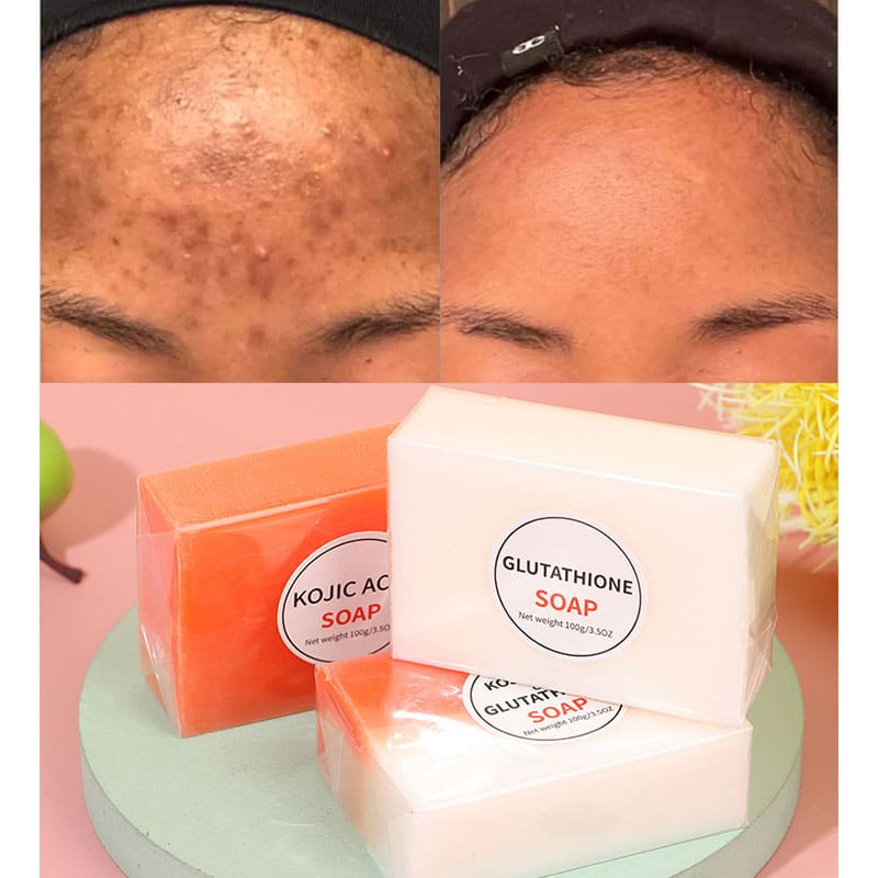 Kojic Acid Soap Before and After: Does It Really Lighten Skin?
