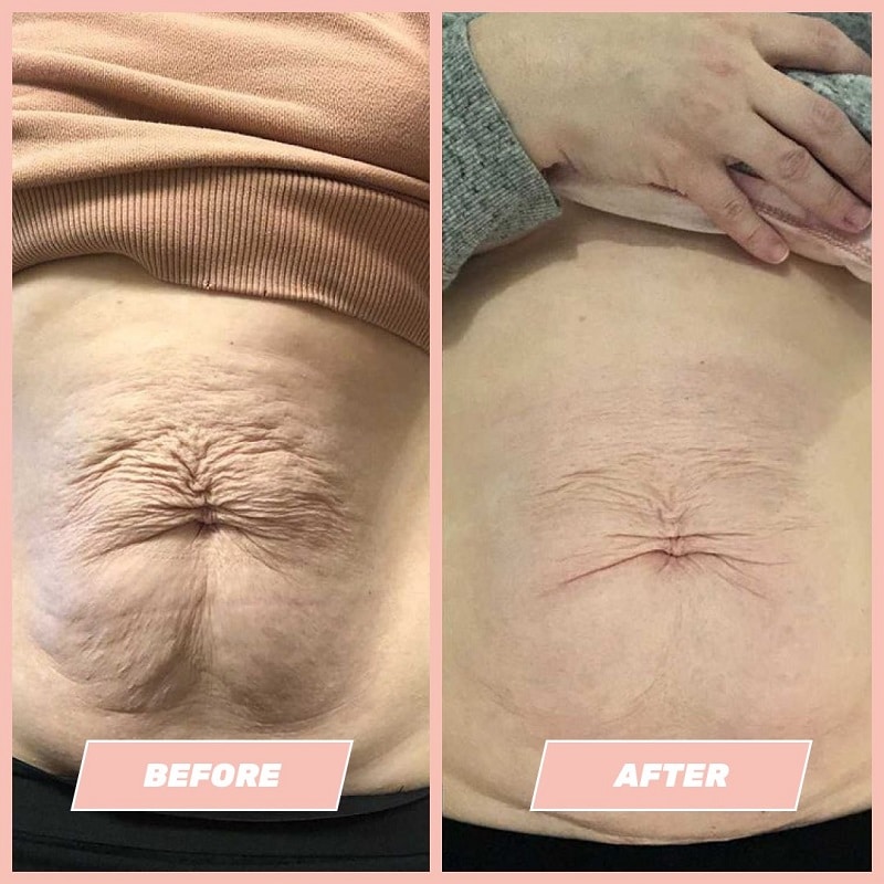 Maelys Cosmetics Before and After: A Comprehensive Review of the Results 14 Maelys Cosmetics Before and After: A Comprehensive Review of the Results