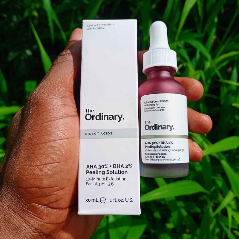 The Ordinary Peeling Solution Before and After: A Comprehensive Review