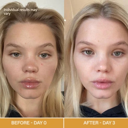 Red Light Therapy Before and After: Does It Really Work? 14 Red Light Therapy Before and After: Does It Really Work?