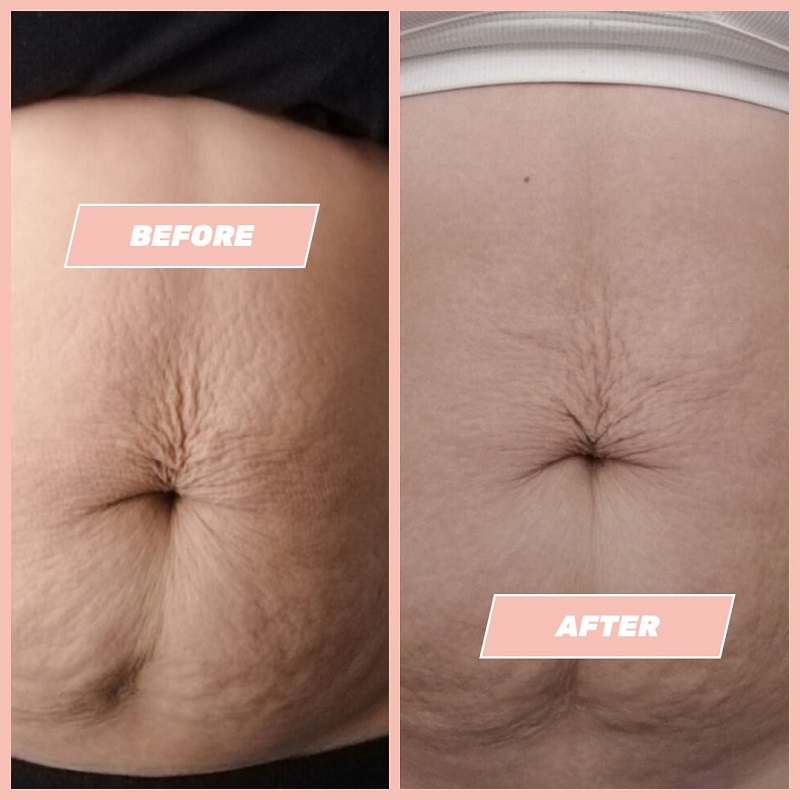 Maelys Cosmetics Before and After: A Comprehensive Review of the Results 15 Maelys Cosmetics Before and After: A Comprehensive Review of the Results