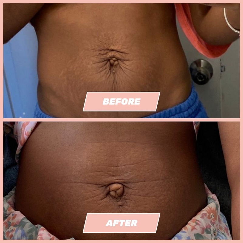 Maelys Cosmetics Before and After: A Comprehensive Review of the Results 16 Maelys Cosmetics Before and After: A Comprehensive Review of the Results