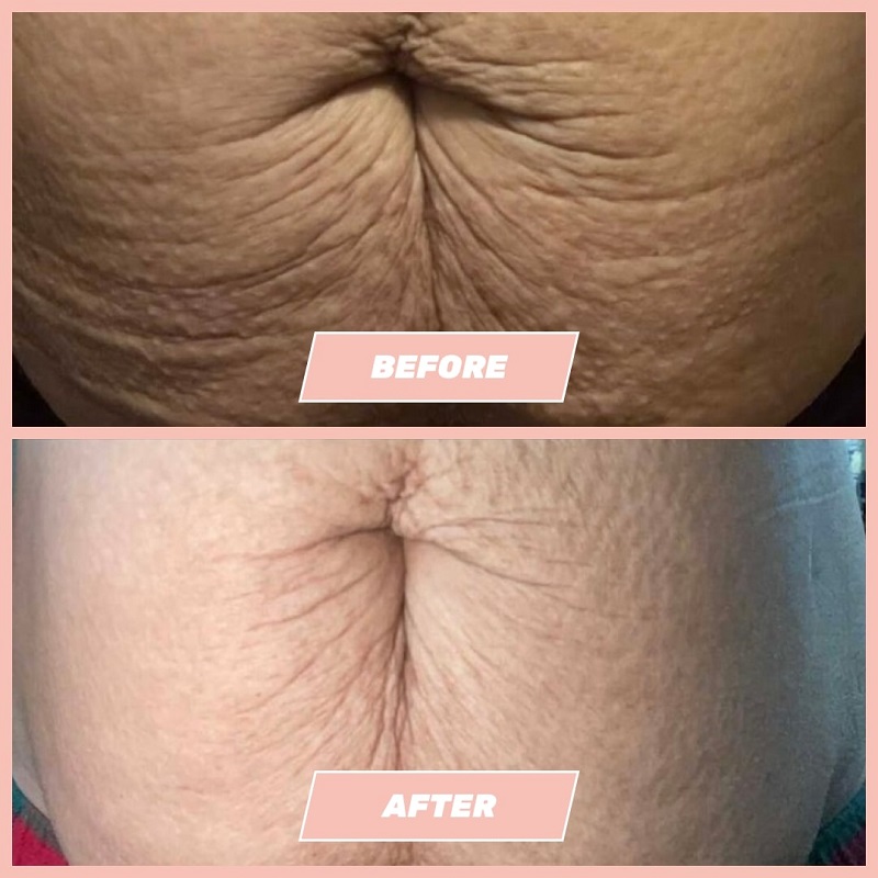 Maelys Cosmetics Before and After: A Comprehensive Review of the Results 17 Maelys Cosmetics Before and After: A Comprehensive Review of the Results