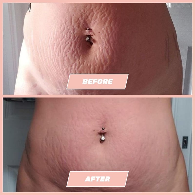Maelys Cosmetics Before and After: A Comprehensive Review of the Results 18 Maelys Cosmetics Before and After: A Comprehensive Review of the Results
