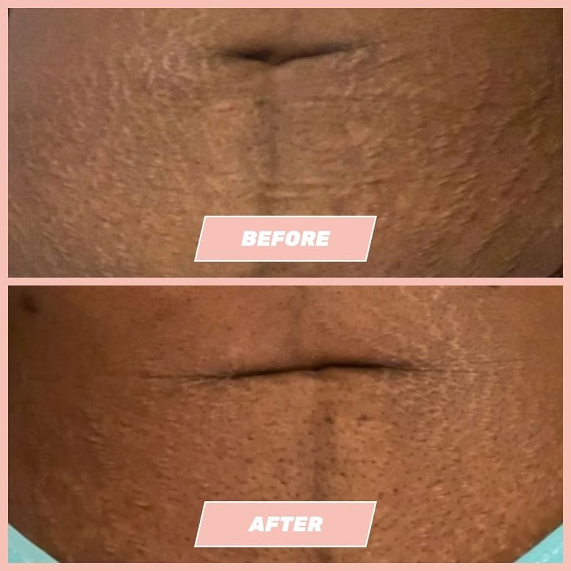 Maelys Cosmetics Before and After: A Comprehensive Review of the Results 19 Maelys Cosmetics Before and After: A Comprehensive Review of the Results