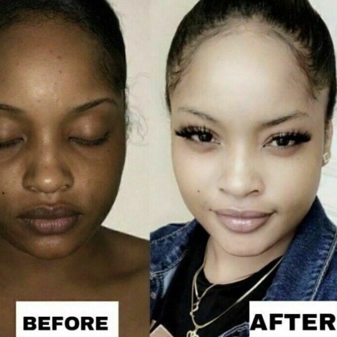 Kojic Acid Soap Before and After: Does It Really Lighten Skin? 20 Kojic Acid Soap Before and After: Does It Really Lighten Skin?