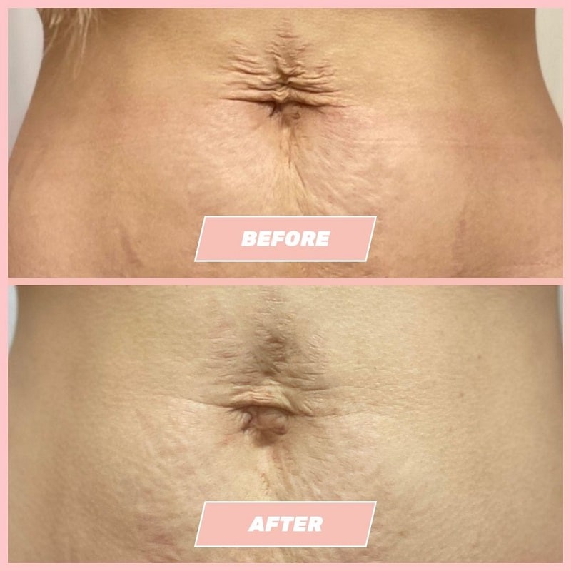 Maelys Cosmetics Before and After: A Comprehensive Review of the Results 20 Maelys Cosmetics Before and After: A Comprehensive Review of the Results