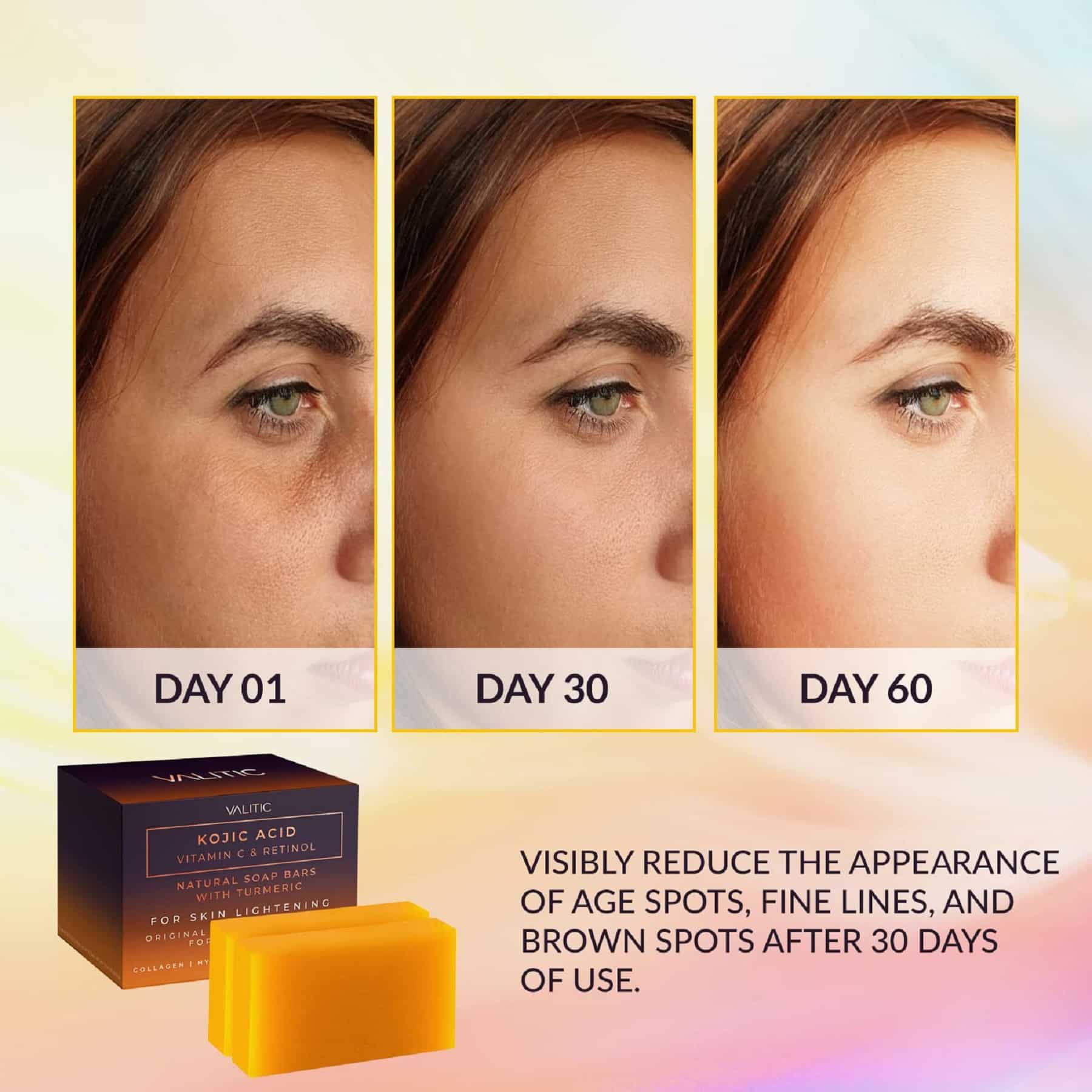 Kojic Acid Soap Before and After Does It Really Lighten Skin? Must Read This Before Buying