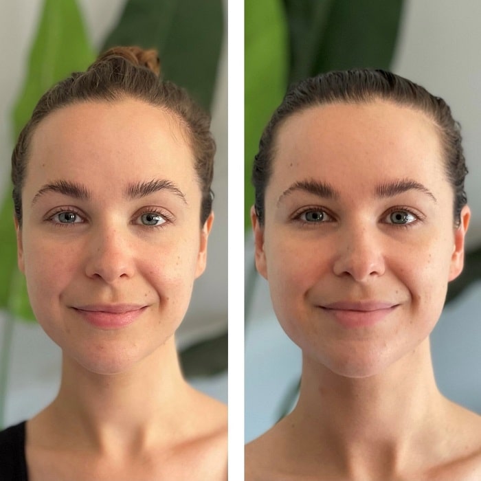 Gua Sha Before and After: Benefits and Results 3 Gua Sha Before and After: Benefits and Results