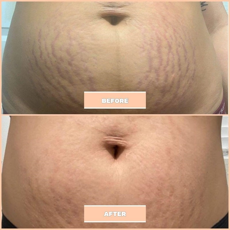 Maelys Cosmetics Before and After: A Comprehensive Review of the Results 22 Maelys Cosmetics Before and After: A Comprehensive Review of the Results