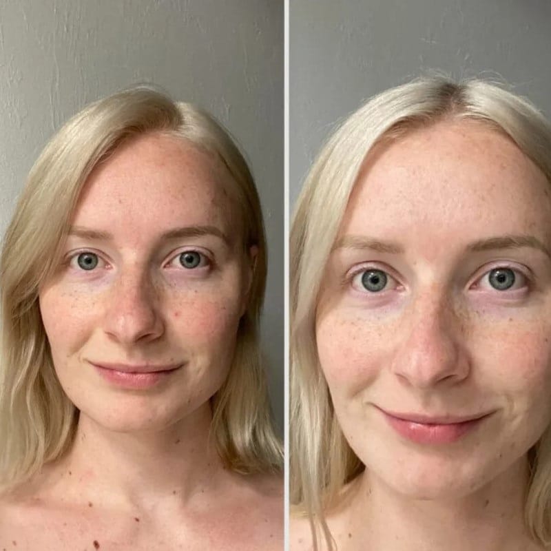 Red Light Therapy Before and After: Does It Really Work? 23 Red Light Therapy Before and After: Does It Really Work?