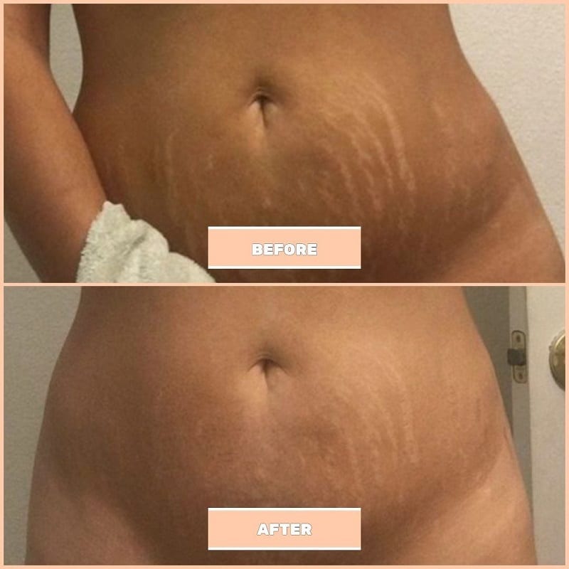 Maelys Cosmetics Before and After: A Comprehensive Review of the Results 23 Maelys Cosmetics Before and After: A Comprehensive Review of the Results