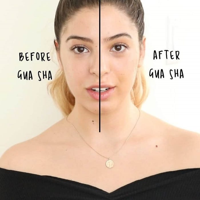Gua Sha Before and After: Benefits and Results 23 Gua Sha Before and After: Benefits and Results