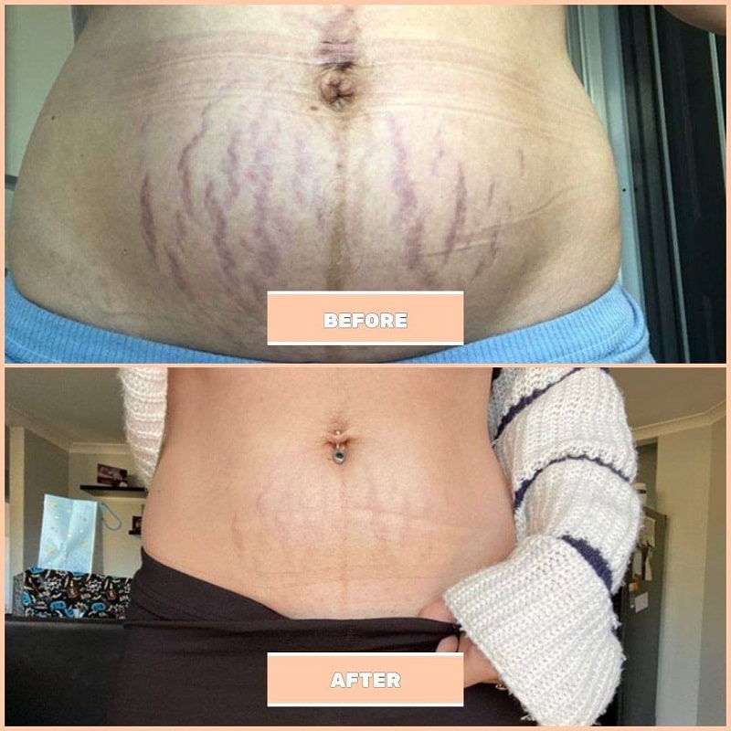 Maelys Cosmetics Before and After: A Comprehensive Review of the Results 26 Maelys Cosmetics Before and After: A Comprehensive Review of the Results