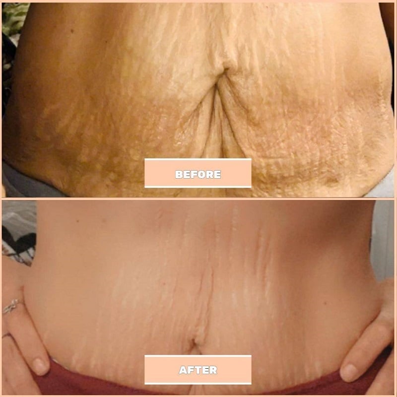 Maelys Cosmetics Before and After: A Comprehensive Review of the Results 27 Maelys Cosmetics Before and After: A Comprehensive Review of the Results