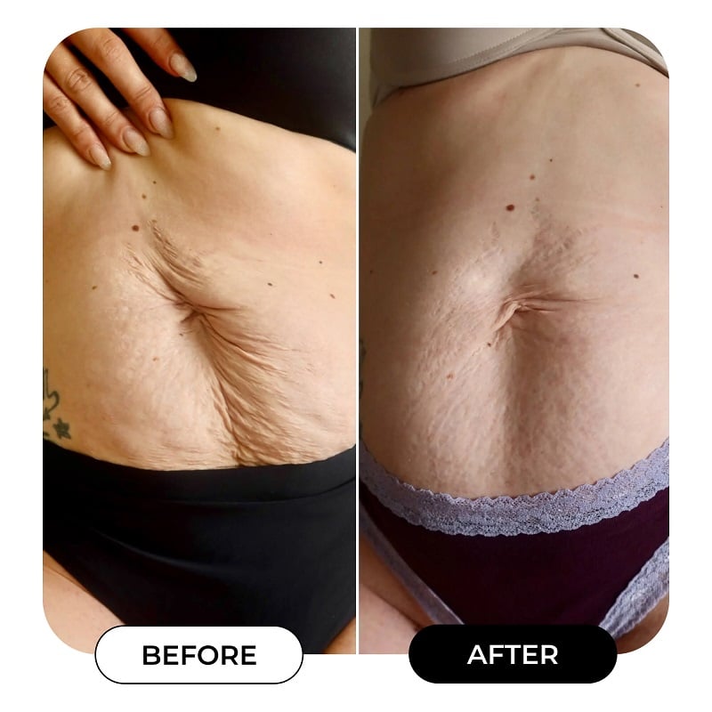 Maelys Cosmetics Before and After: A Comprehensive Review of the Results 28 Maelys Cosmetics Before and After: A Comprehensive Review of the Results