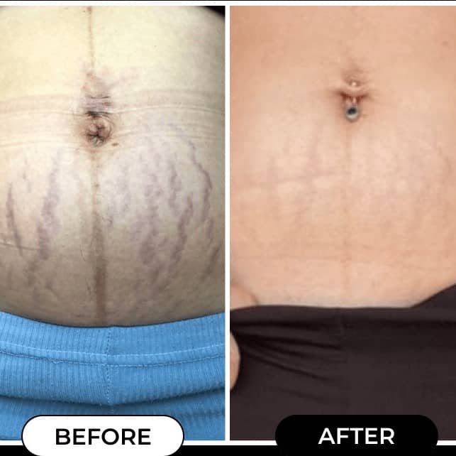 Maelys Cosmetics Before and After: A Comprehensive Review of the Results 29 Maelys Cosmetics Before and After: A Comprehensive Review of the Results