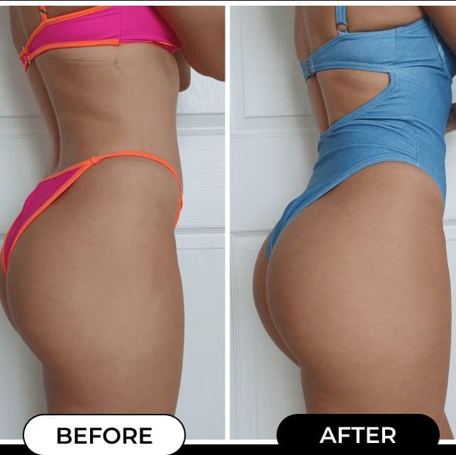 Maelys Cosmetics Before and After: A Comprehensive Review of the Results 30 Maelys Cosmetics Before and After: A Comprehensive Review of the Results