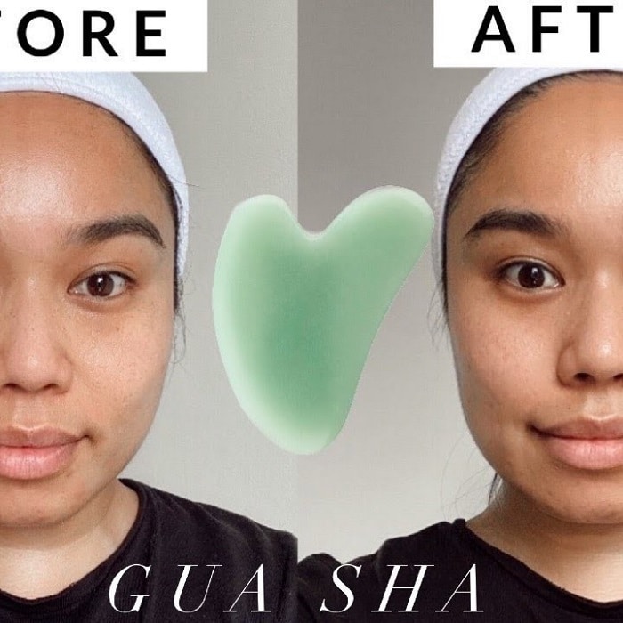 Gua Sha Before and After: Benefits and Results 30 Gua Sha Before and After: Benefits and Results